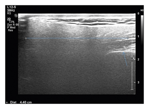 Details are in the caption following the image