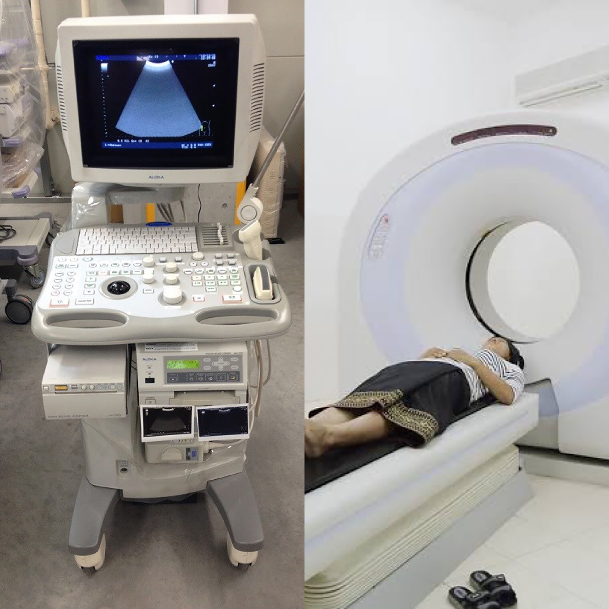 Prognostic and discriminatory abilities of imaging scoring systems in predicting COVID-19 adverse outcomes