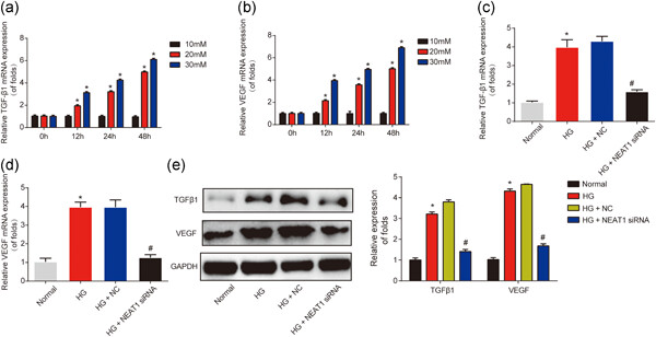 Knockdown of NEAT1 exerts suppressive effects on diabetic retinopathy progression via inactivating TGF-β1 and VEGF signaling pathways
