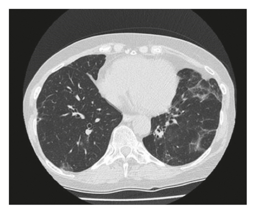 Details are in the caption following the image Details are in the caption following the image