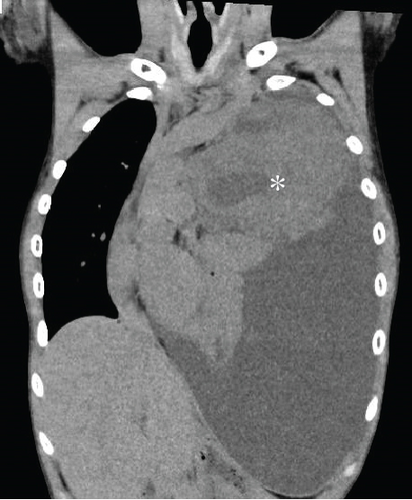 Details are in the caption following the image