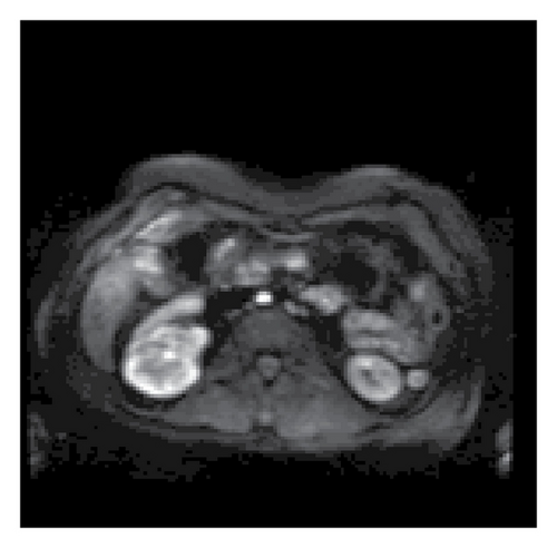 Details are in the caption following the image