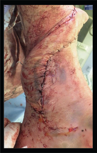 Details are in the caption following the image Details are in the caption following the image