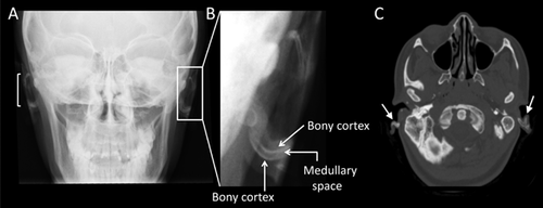 Details are in the caption following the image Details are in the caption following the image