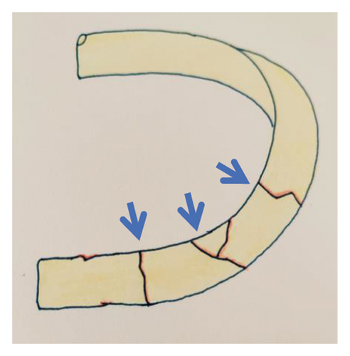Details are in the caption following the image