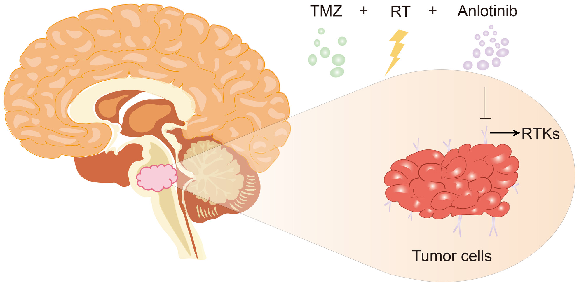 Radiotherapy plus temozolomide with or without anlotinib in H3K27M-mutant diffuse midline glioma: A retrospective cohort study