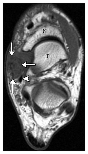 Details are in the caption following the image