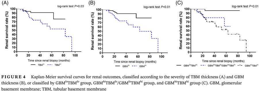 Combining glomerular basement membrane and tubular basement membrane assessment improves the prediction of diabetic end-stage renal disease 联合评估肾小球基底膜厚度和肾小管基底膜厚度可提高糖尿病肾病进展为终末期肾脏病的预测能力