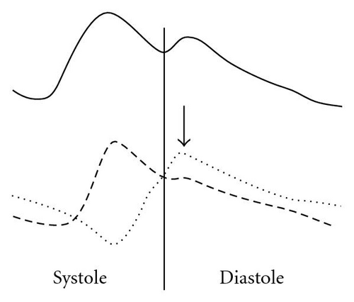 Details are in the caption following the image