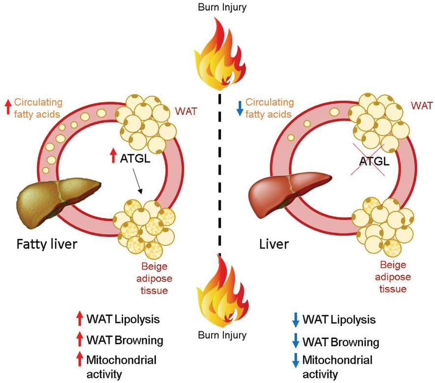 Adipose-specific ATGL ablation reduces burn injury-induced metabolic derangements in mice