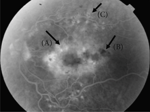Details are in the caption following the image