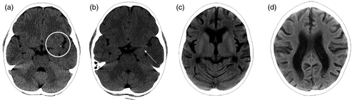 Details are in the caption following the image