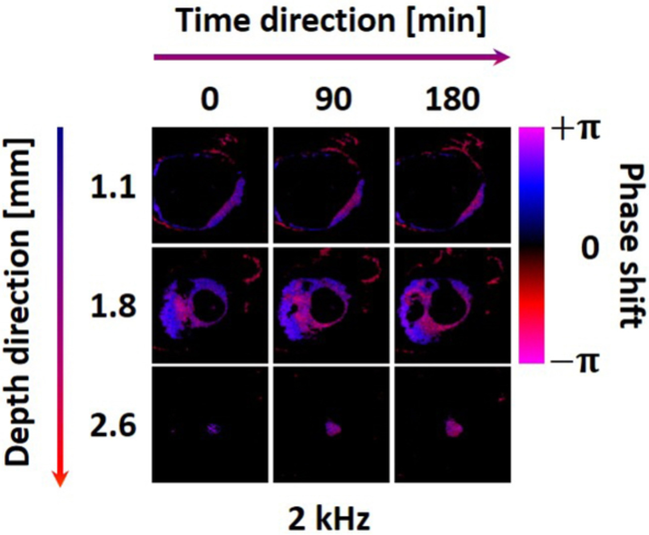 Functional assessment of moisture influenced cadaveric tympanic membrane using phase shift-resolved optical Doppler vibrography