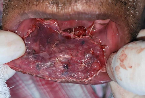 Details are in the caption following the image Details are in the caption following the image
