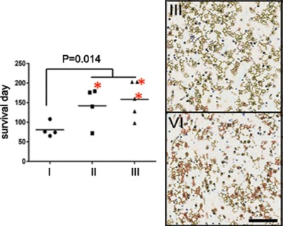 Hematopoietic Stem cell transplantation and lentiviral vector-based gene therapy for Krabbe's disease: Present convictions and future prospects
