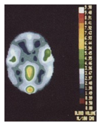 Details are in the caption following the image