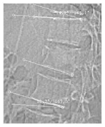 Details are in the caption following the image