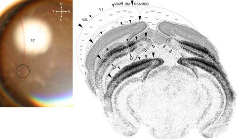Retinal lesions induce fast intrinsic cortical plasticity in adult mouse visual system
