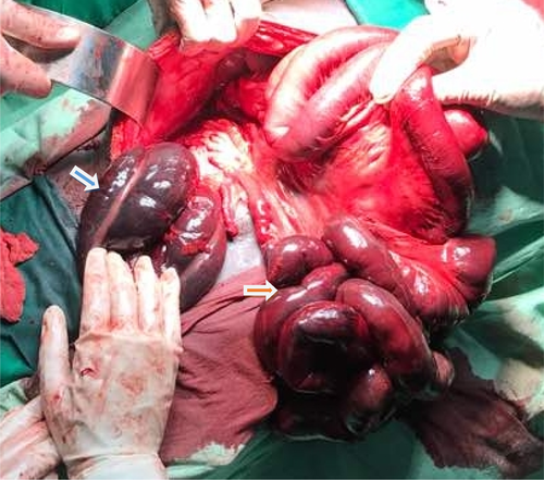 Details are in the caption following the image Details are in the caption following the image