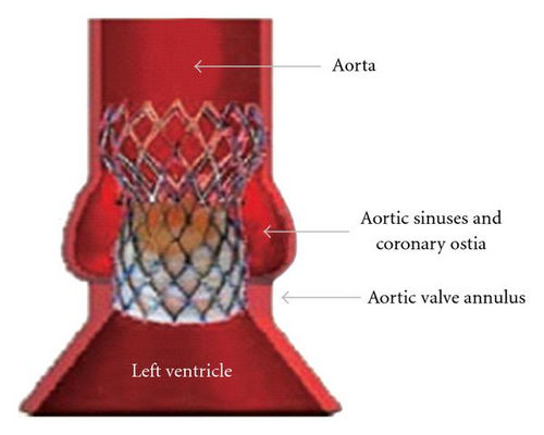 Details are in the caption following the image