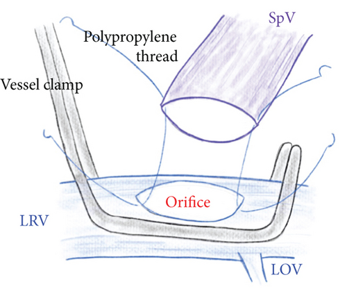 Details are in the caption following the image