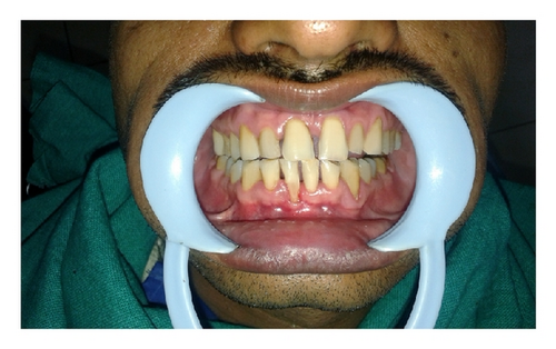 Details are in the caption following the image Details are in the caption following the image