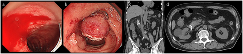 Details are in the caption following the image Details are in the caption following the image