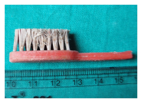 Details are in the caption following the image