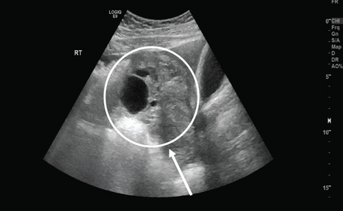 Details are in the caption following the image