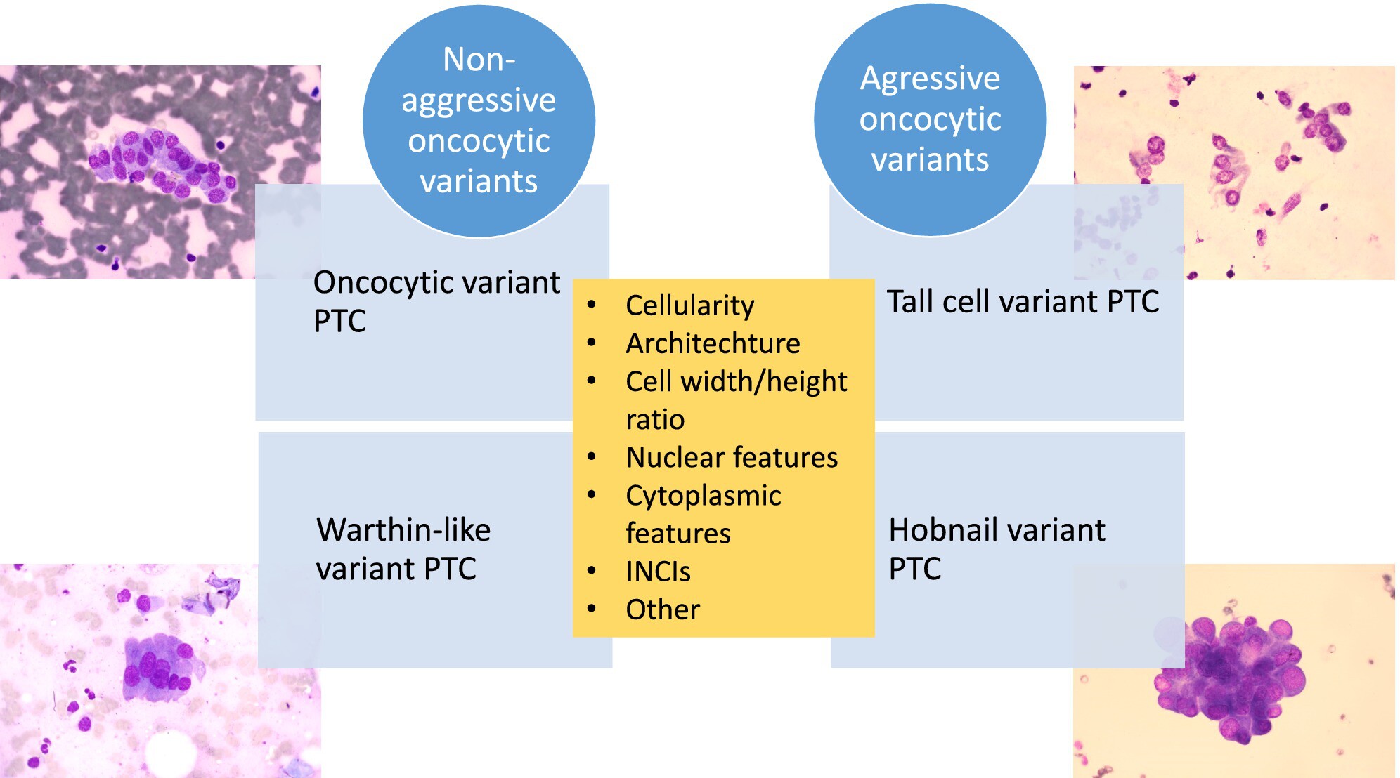 Can Aggressive Papillary Thyroid Carcinoma Variants With Oncocytıc Morphology (Tall Cell and Hobnail Variants) be Detected Cytologically? Is the Differentiation as Straightforward as Reported?