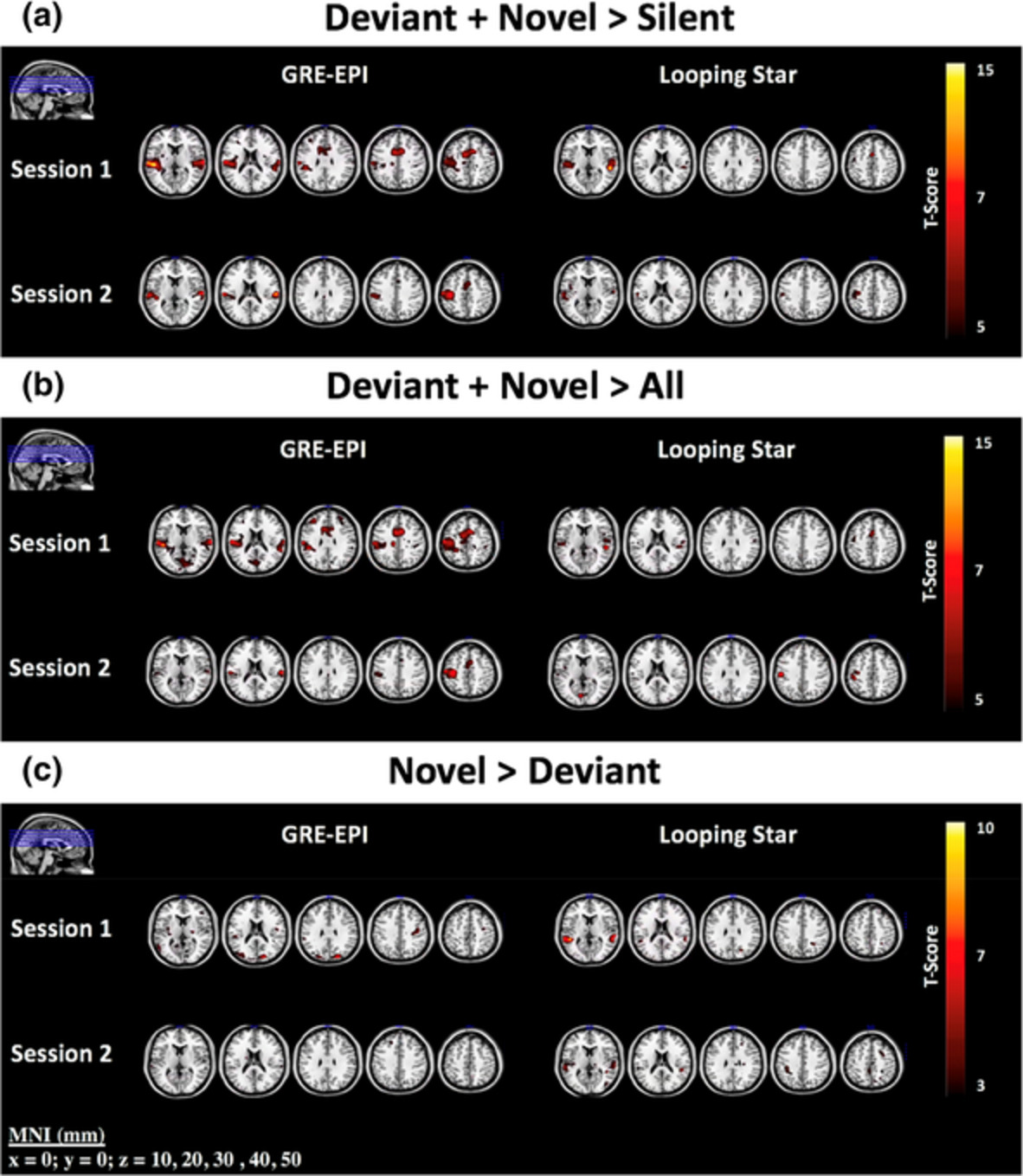 Revealing the mechanisms behind novel auditory stimuli discrimination: An evaluation of silent functional MRI using looping star