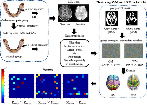 Effect of experimental orthodontic pain on gray and white matter functional connectivity