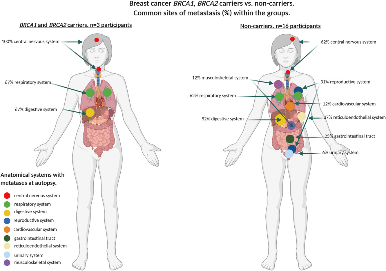 BRCA1 and BRCA2 carriers with breast, ovarian and prostate cancer demonstrate a different pattern of metastatic disease compared with non-carriers: results from a rapid autopsy programme