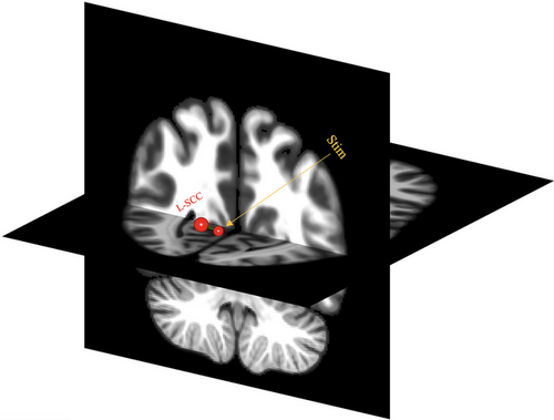 Details are in the caption following the image