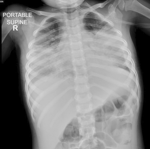 Details are in the caption following the image