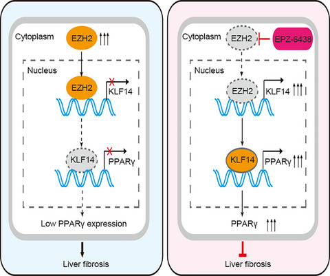 EZH2-mediated inhibition of KLF14 expression promotes HSCs activation and liver fibrosis by downregulating PPARγ