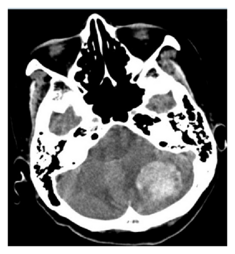 Details are in the caption following the image