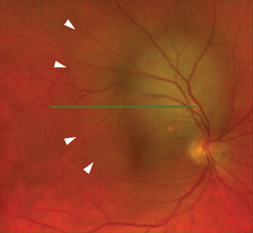 Details are in the caption following the image Details are in the caption following the image