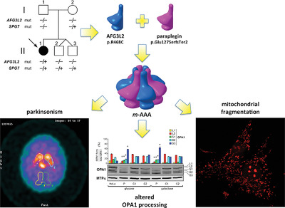 Concurrent AFG3L2 and SPG7 mutations associated with syndromic parkinsonism and optic atrophy with aberrant OPA1 processing and mitochondrial network fragmentation