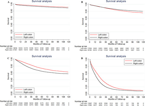 Comparison of survival between right-sided and left-sided colon cancer in different situations
