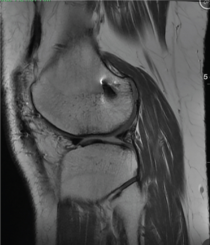 Details are in the caption following the image