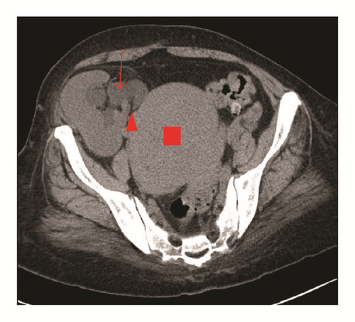 Details are in the caption following the image Details are in the caption following the image