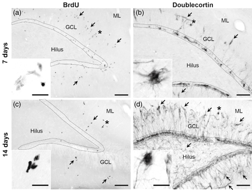 Ectopic hippocampal neurogenesis in adolescent male rats following alcohol dependence