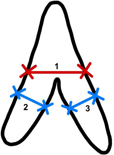 Details are in the caption following the image