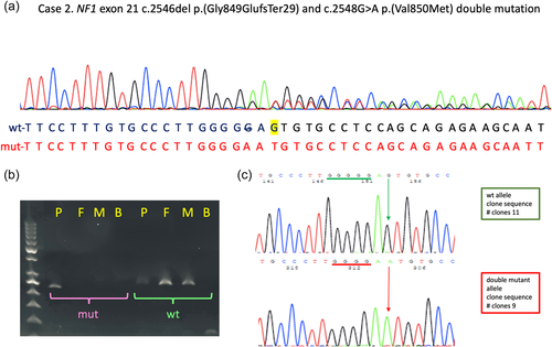 Details are in the caption following the image Details are in the caption following the image