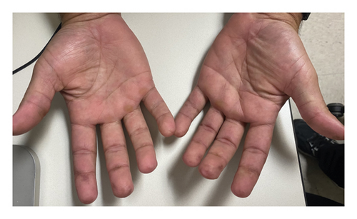 Details are in the caption following the image Details are in the caption following the image