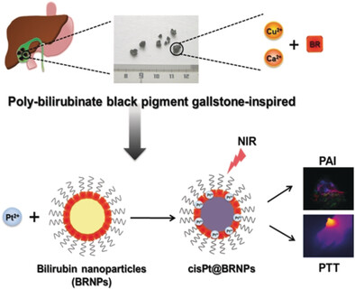 Black Pigment Gallstone Inspired Platinum-Chelated Bilirubin Nanoparticles for Combined Photoacoustic Imaging and Photothermal Therapy of Cancers