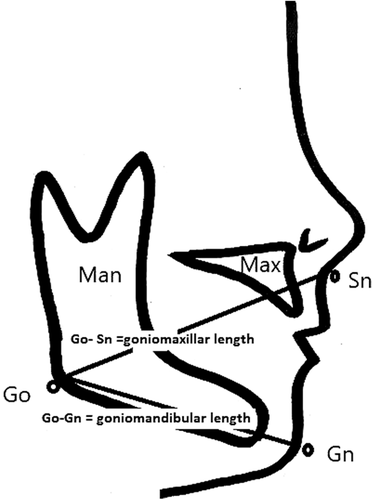 Details are in the caption following the image