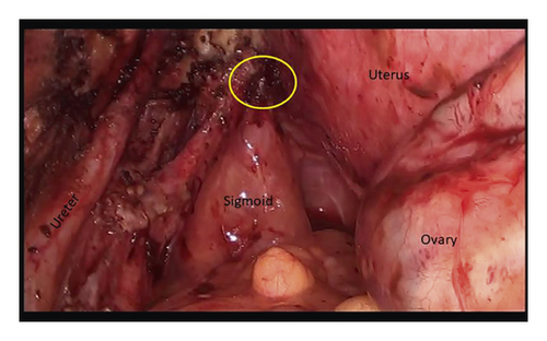Details are in the caption following the image Details are in the caption following the image