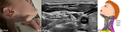 Details are in the caption following the image Details are in the caption following the image